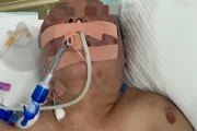开云官网-被前夫打进ICU的女子情况仍不稳定，其8岁女儿也曾遭父亲扇脸，律师：已构成故意伤害罪，或同时涉虐待罪